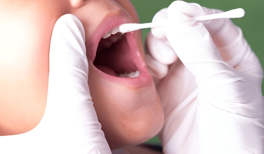 fluoride treatment in london, on