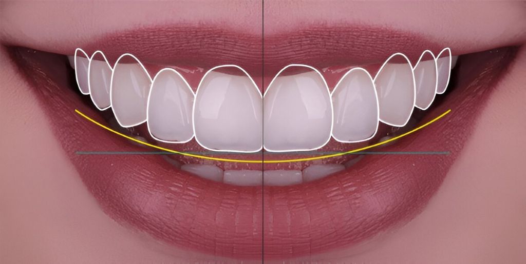 smile makeover in london, on