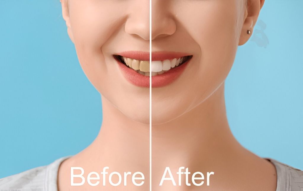 smile makeover near you