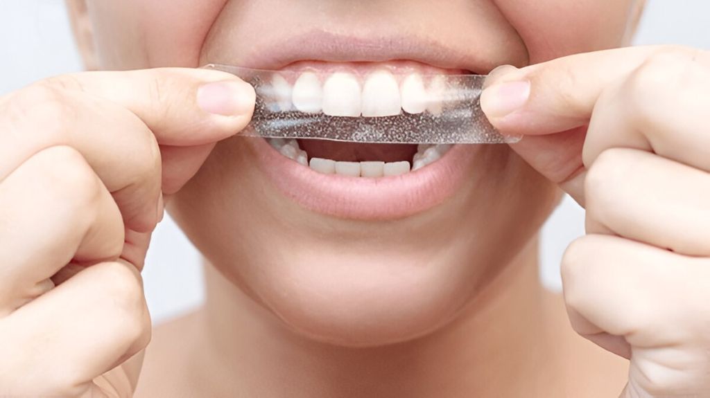 teeth whitening treatment in london, on