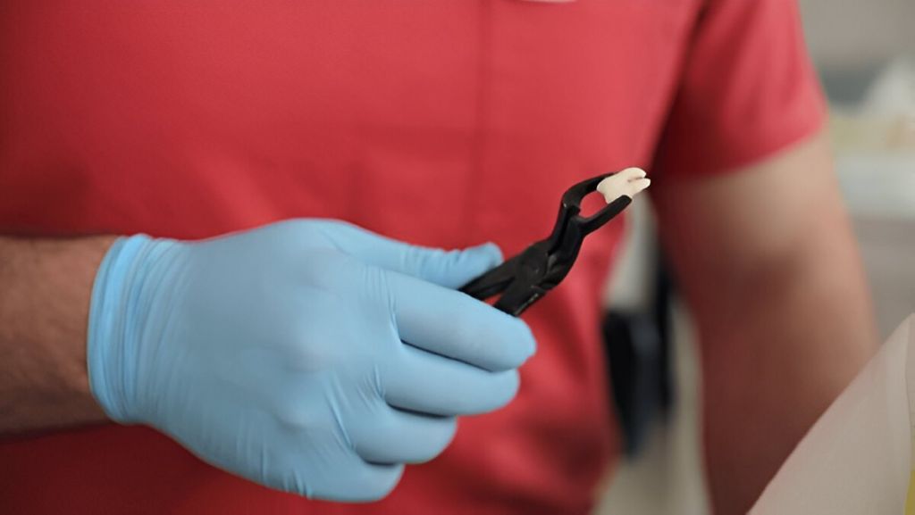 tooth extractions near you