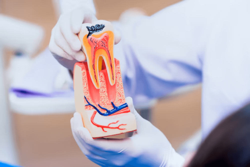 How Root Canal Therapy Helps Relieve Severe Tooth Pain