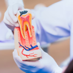 Root canal therapy provides safe, effective relief from tooth pain while saving your natural tooth. Schedule your appointment with expert care today.