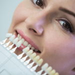 How Veneers Can Fix Chips, Gaps, and Discoloration