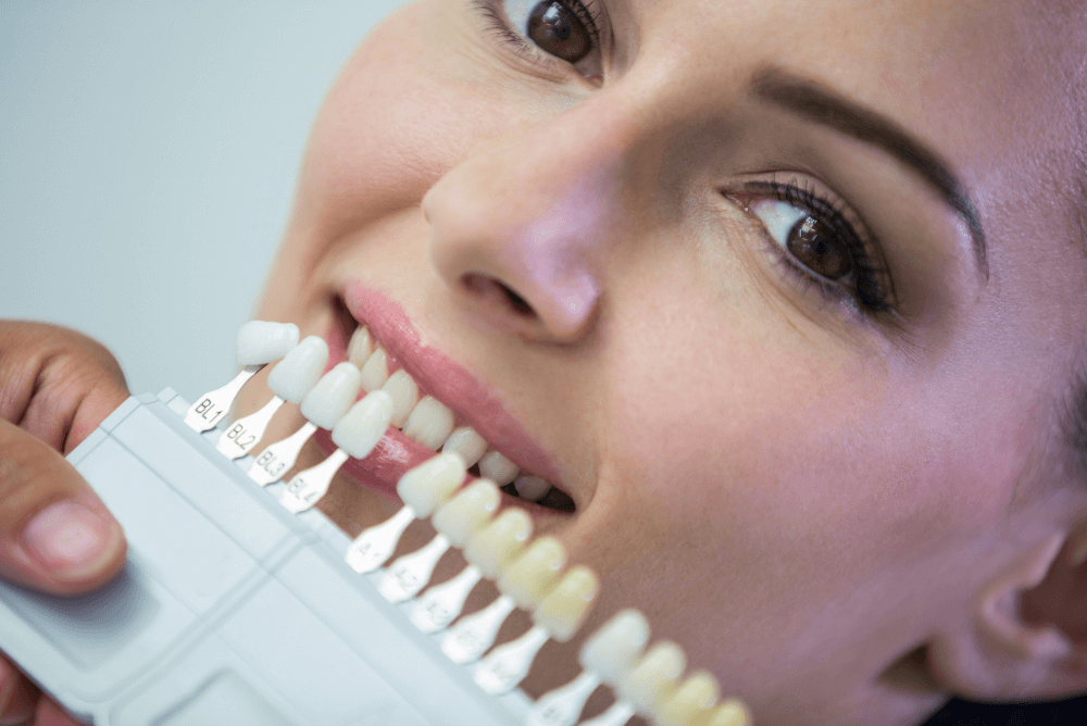How Veneers Can Fix Chips, Gaps, and Discoloration