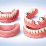 full and partial dentures designed to restore missing teeth and improve oral function