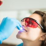 bright smile after professional teeth whitening